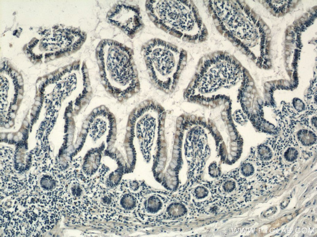 RHOF Antibody in Immunohistochemistry (Paraffin) (IHC (P))