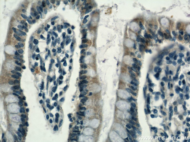 RHOF Antibody in Immunohistochemistry (Paraffin) (IHC (P))