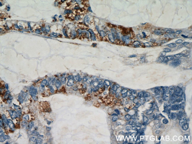 RHOF Antibody in Immunohistochemistry (Paraffin) (IHC (P))