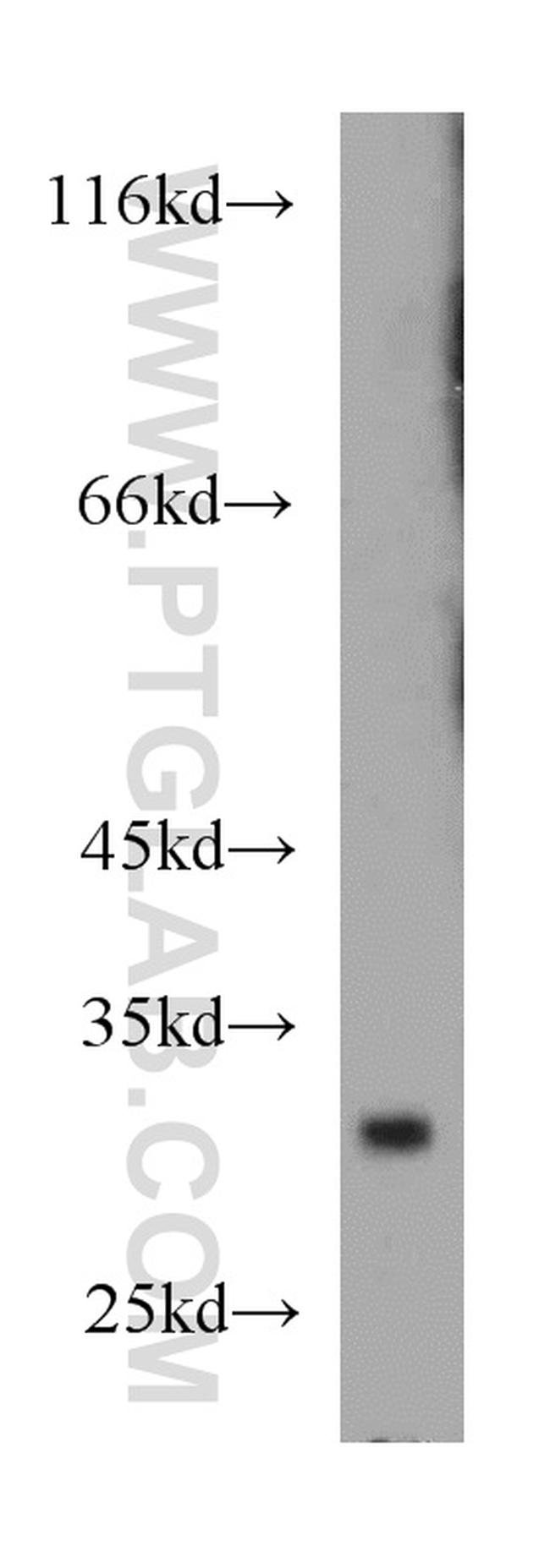 TSPAN6 Antibody in Western Blot (WB)