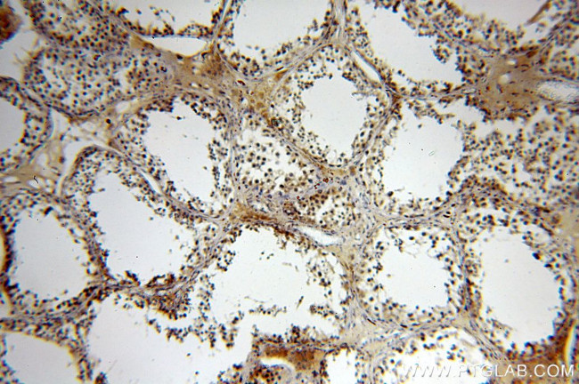 Neurotrophin 4 Antibody in Immunohistochemistry (Paraffin) (IHC (P))