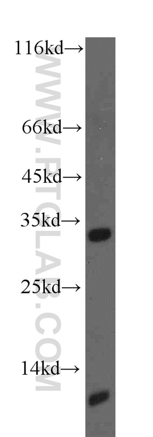 ACYP2 Antibody in Western Blot (WB)
