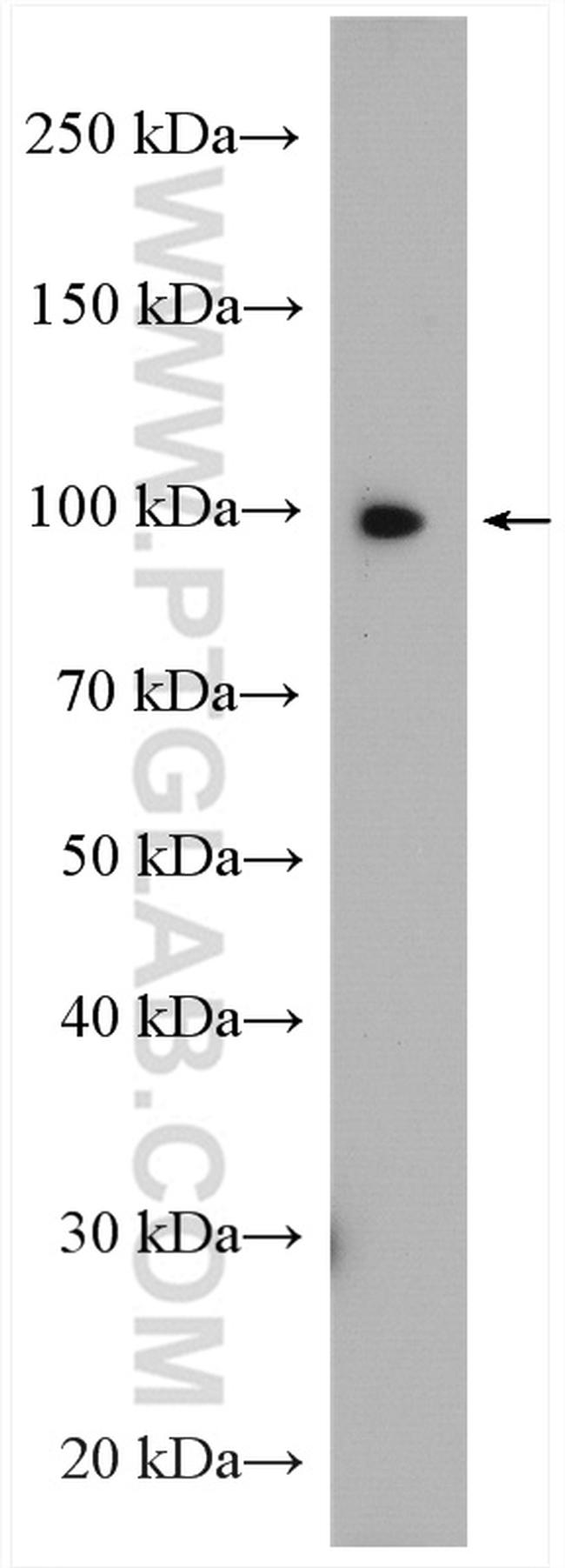 SCYL2 Antibody in Western Blot (WB)