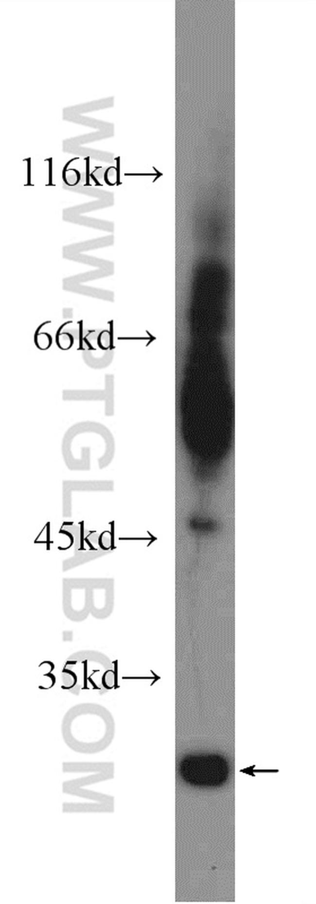 TIMP-4 Antibody in Western Blot (WB)