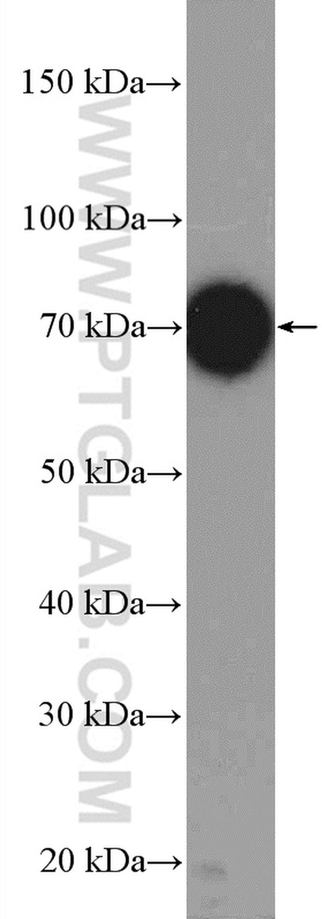 UBE3C Antibody in Western Blot (WB)