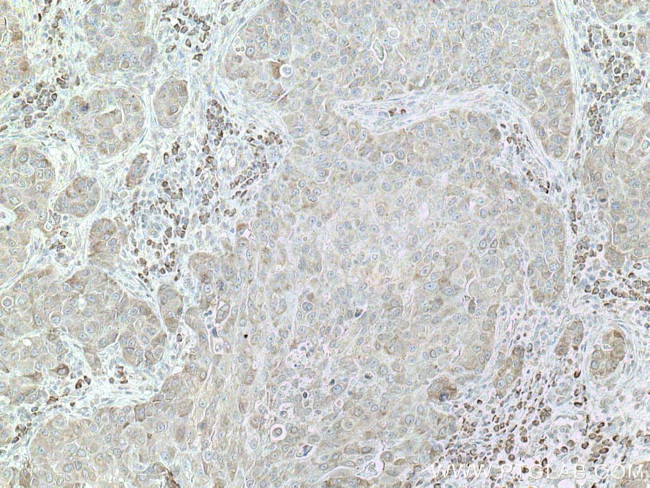 DNAJC1 Antibody in Immunohistochemistry (Paraffin) (IHC (P))