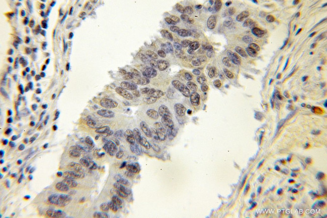 DNAJC1 Antibody in Immunohistochemistry (Paraffin) (IHC (P))