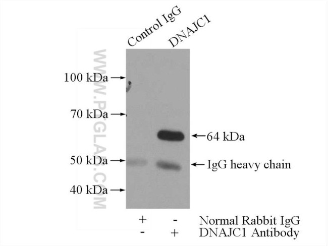 DNAJC1 Antibody in Immunoprecipitation (IP)