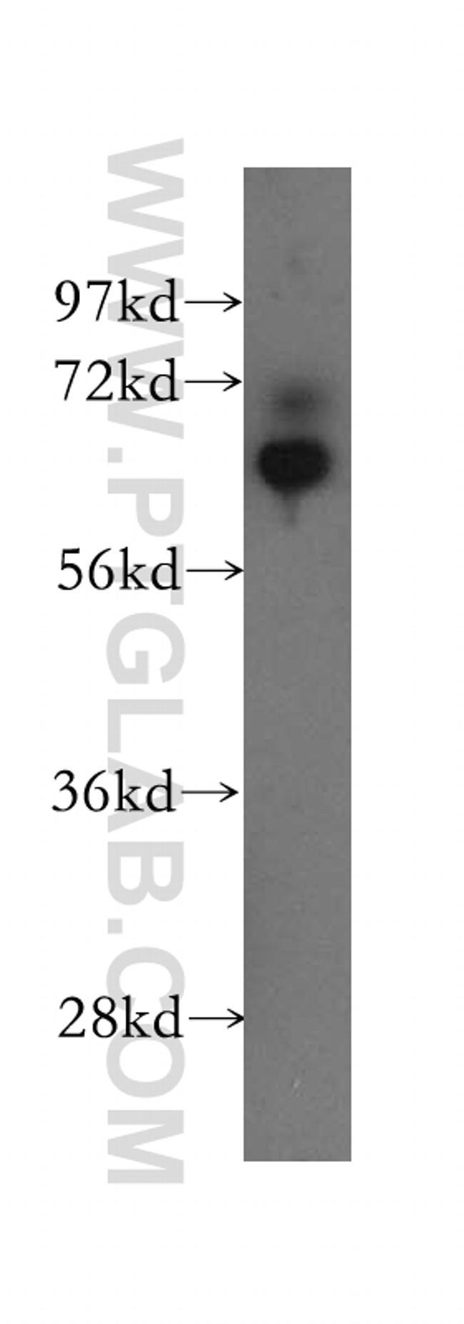 DNAJC1 Antibody in Western Blot (WB)