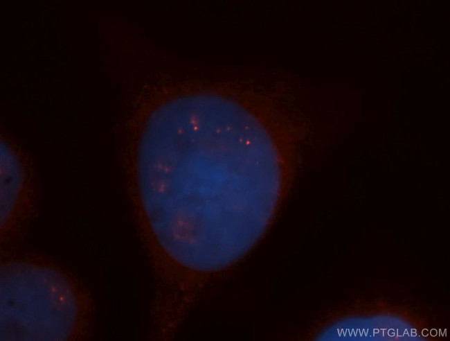 CCNDBP1 Antibody in Immunocytochemistry (ICC/IF)