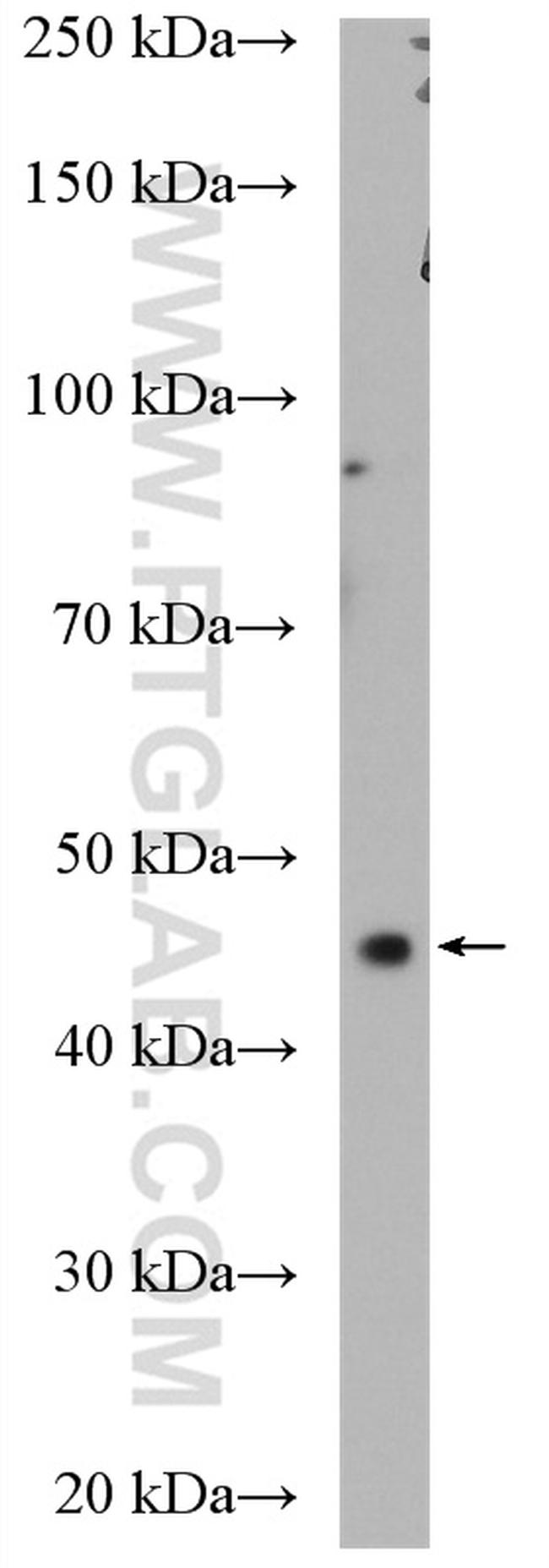 CCNDBP1 Antibody in Western Blot (WB)