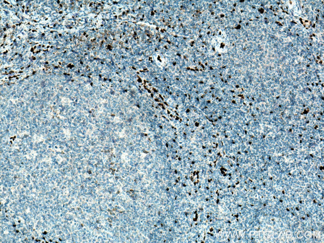 IL33 Antibody in Immunohistochemistry (Paraffin) (IHC (P))