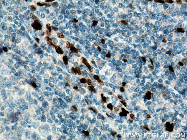 IL33 Antibody in Immunohistochemistry (Paraffin) (IHC (P))