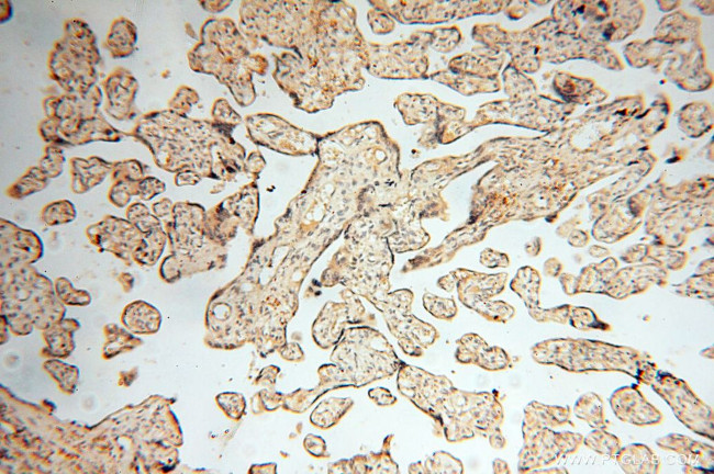 COX2 Antibody in Immunohistochemistry (Paraffin) (IHC (P))