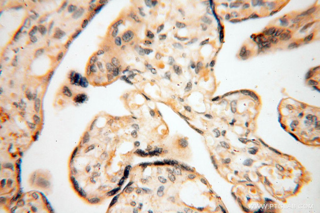 COX2 Antibody in Immunohistochemistry (Paraffin) (IHC (P))