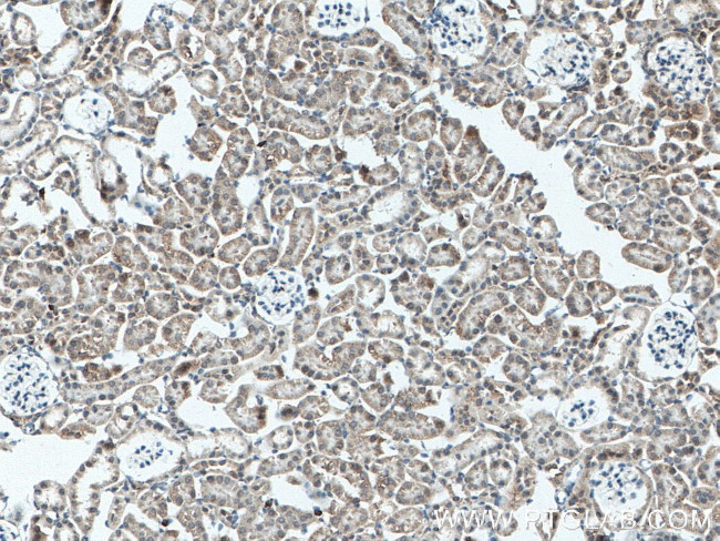 A4GALT Antibody in Immunohistochemistry (Paraffin) (IHC (P))