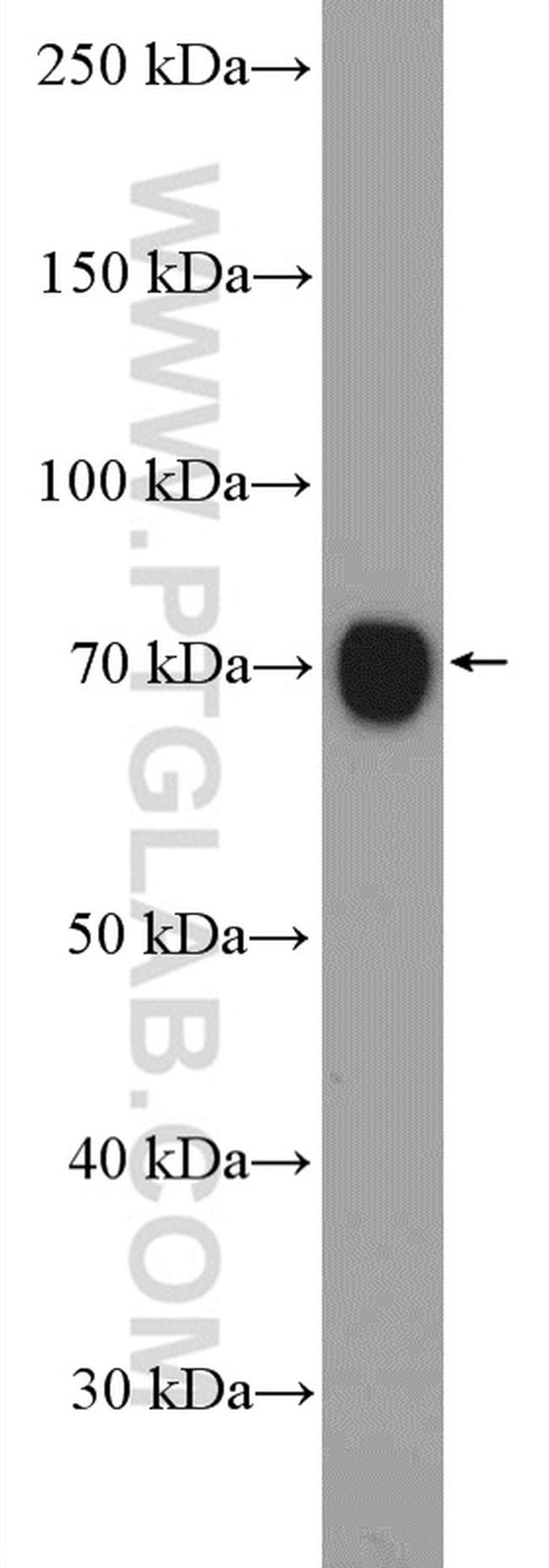 STAM Antibody in Western Blot (WB)