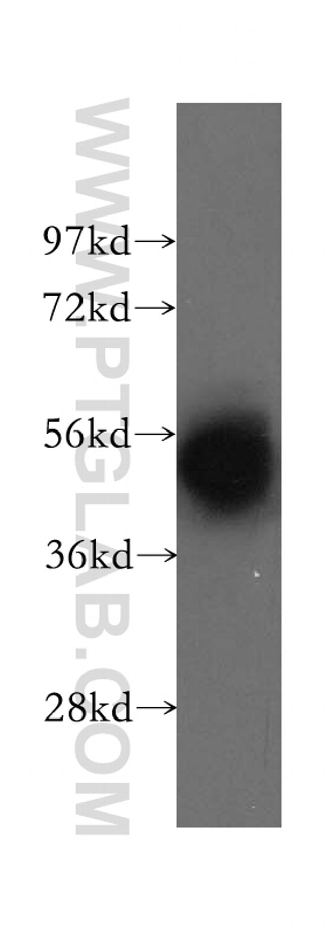 DBT Antibody in Western Blot (WB)