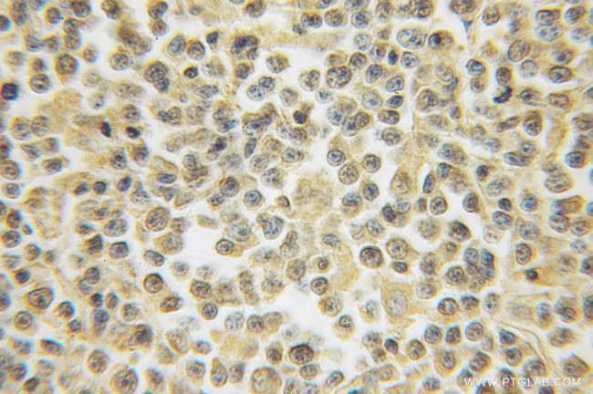 HS2ST1 Antibody in Immunohistochemistry (Paraffin) (IHC (P))