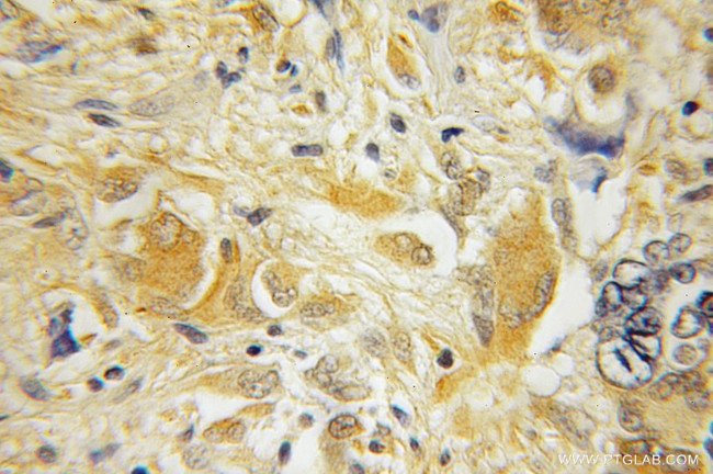 HPCAL4 Antibody in Immunohistochemistry (Paraffin) (IHC (P))