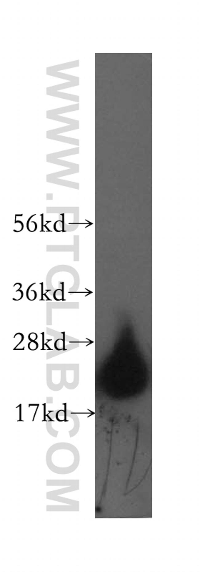 HPCAL4 Antibody in Western Blot (WB)