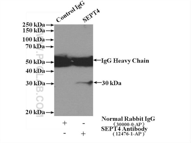 SEPT4 Antibody in Immunoprecipitation (IP)