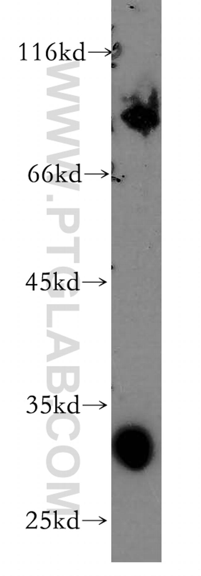 SEPT4 Antibody in Western Blot (WB)