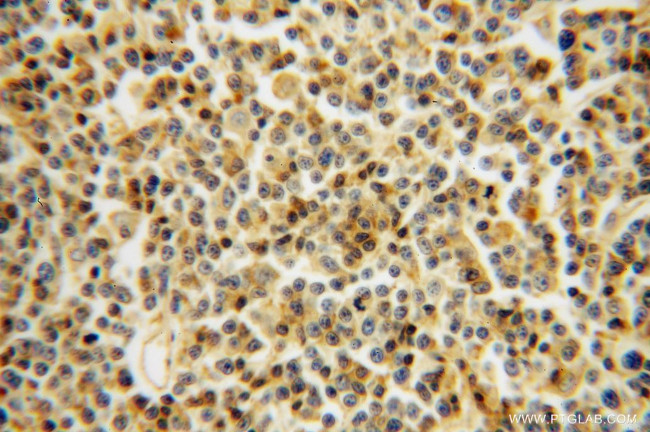 LCK Antibody in Immunohistochemistry (Paraffin) (IHC (P))