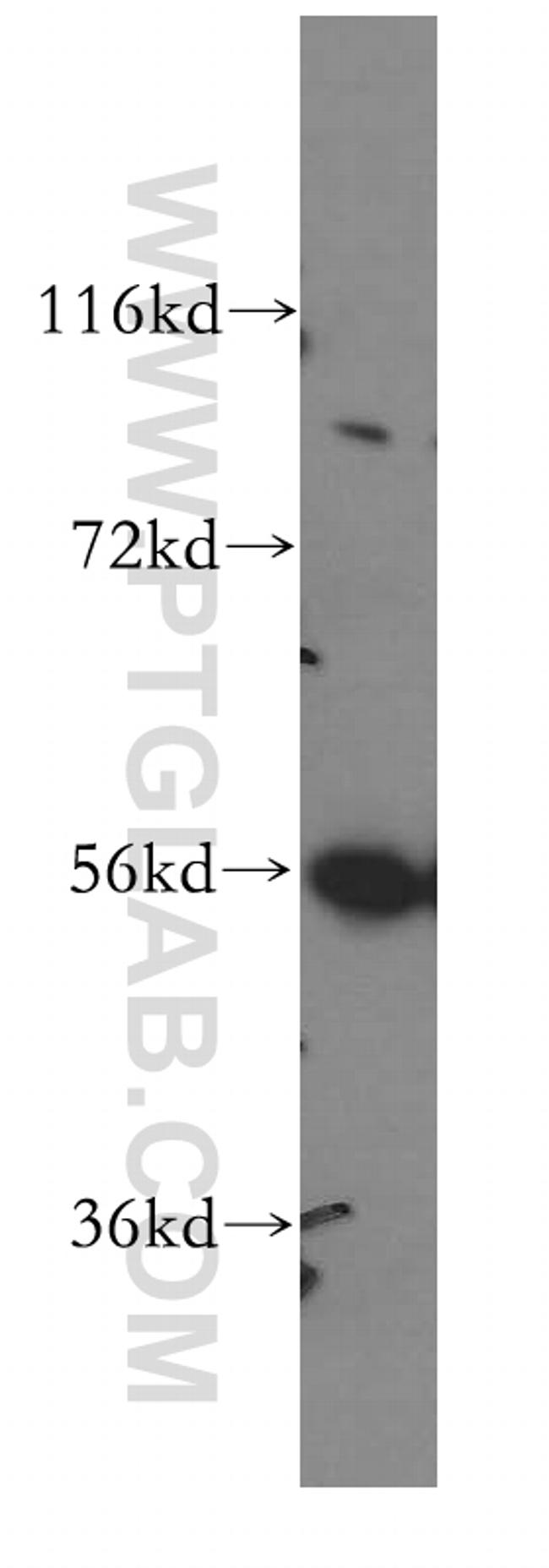 LCK Antibody in Western Blot (WB)