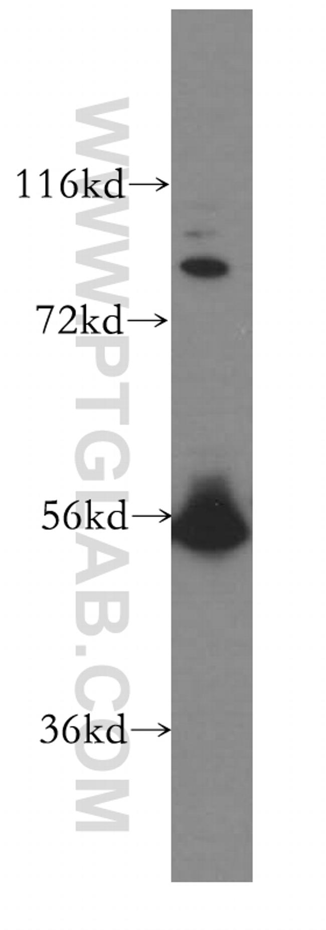 LCK Antibody in Western Blot (WB)