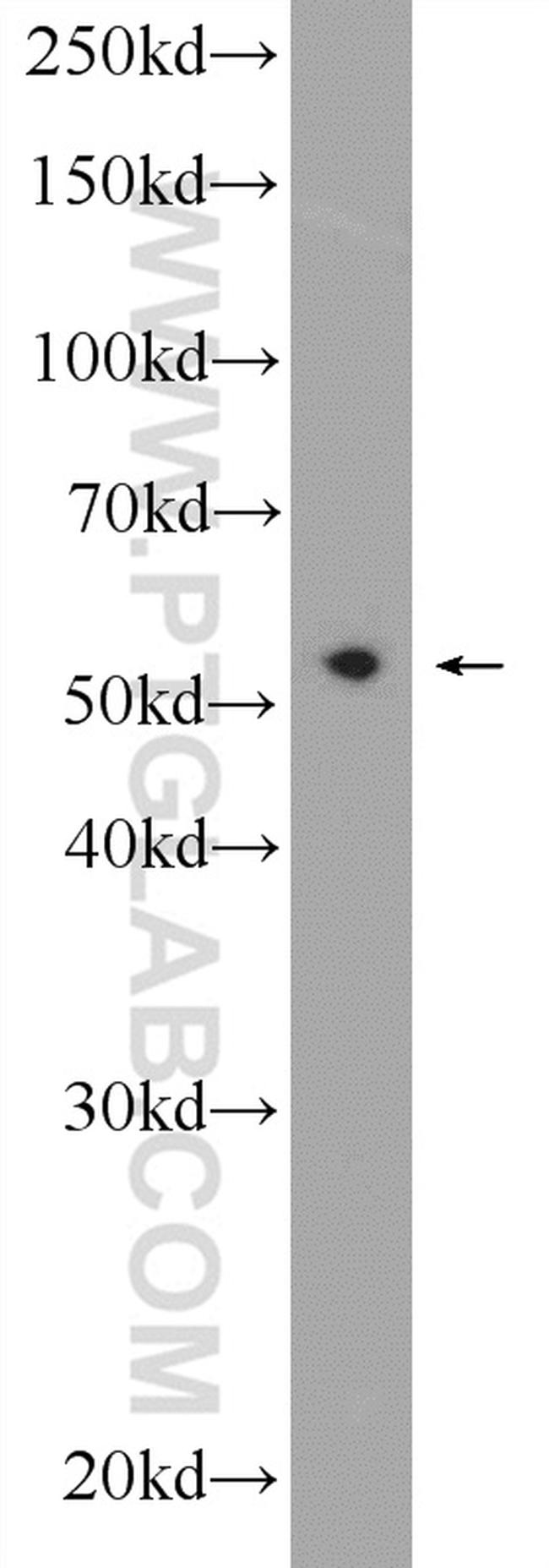 PDCD7 Antibody in Western Blot (WB)