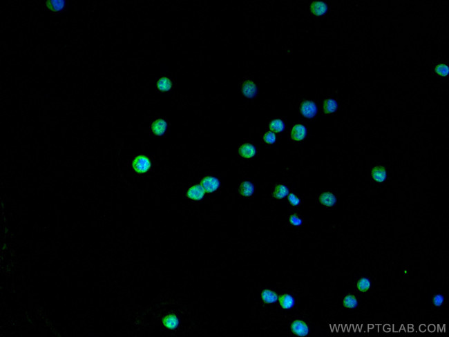 IRF2 Antibody in Immunocytochemistry (ICC/IF)