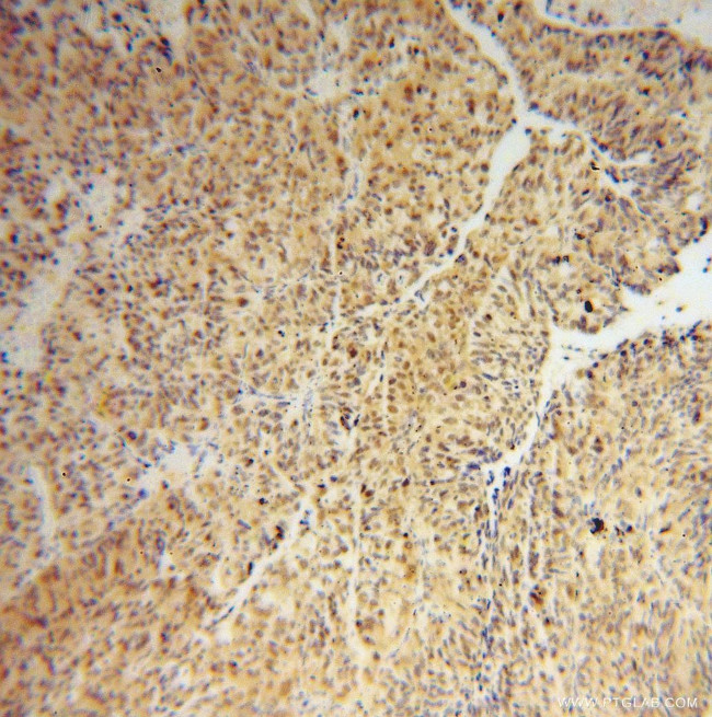 IRF2 Antibody in Immunohistochemistry (Paraffin) (IHC (P))