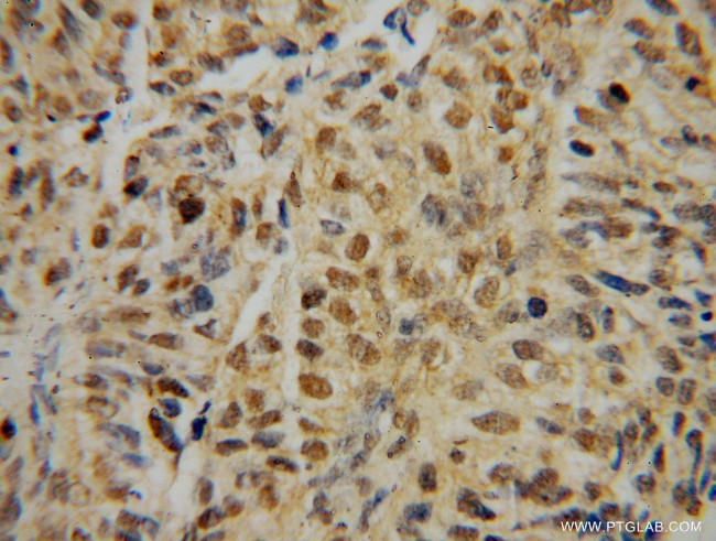 IRF2 Antibody in Immunohistochemistry (Paraffin) (IHC (P))