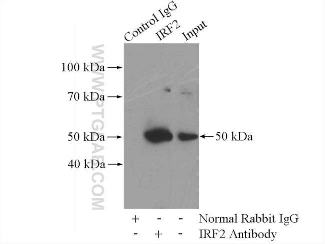 IRF2 Antibody in Immunoprecipitation (IP)