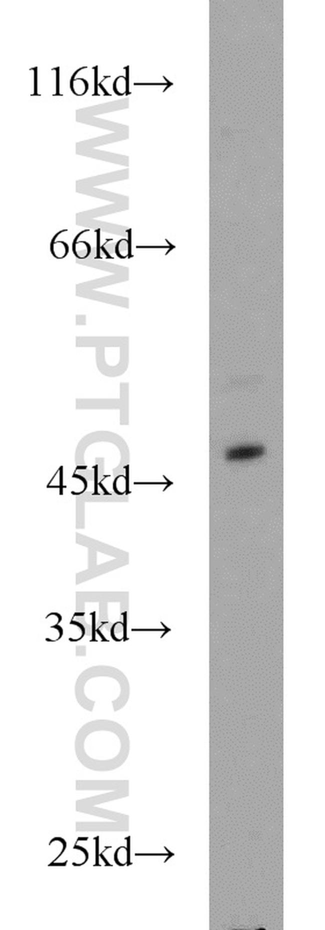 IRF2 Antibody in Western Blot (WB)