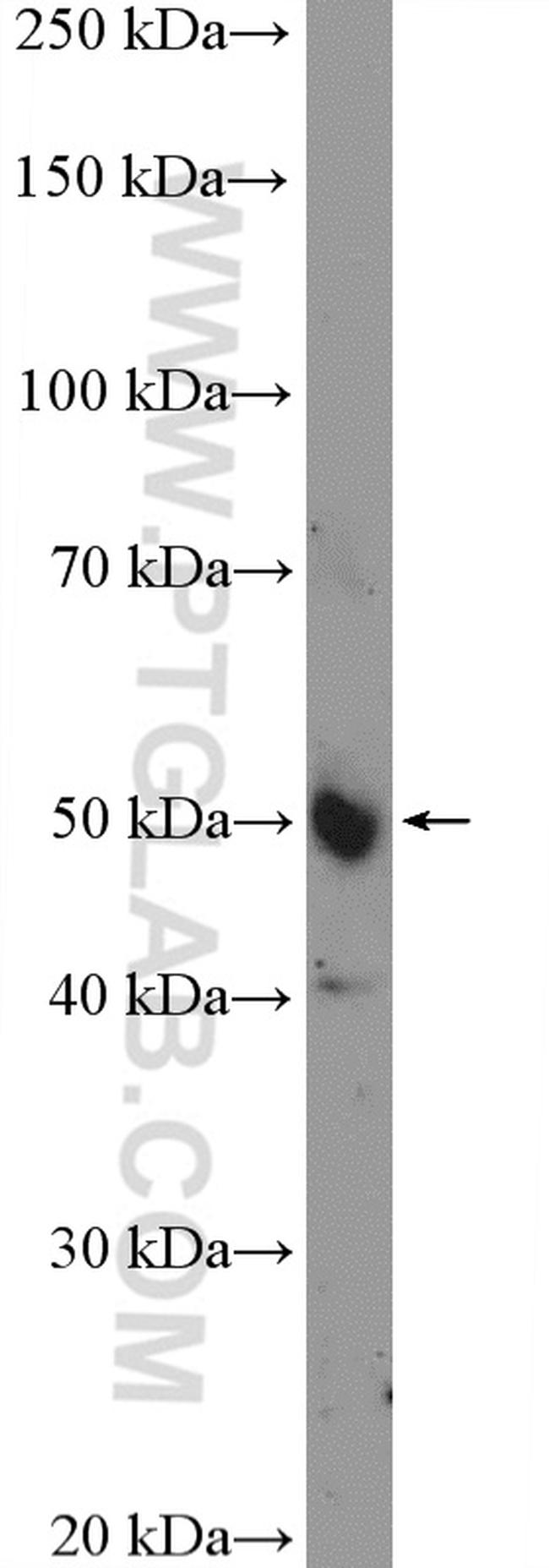 IRF2 Antibody in Western Blot (WB)