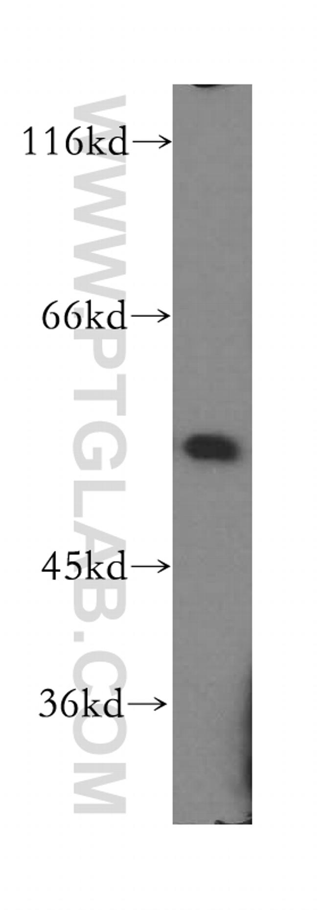 IRF2 Antibody in Western Blot (WB)