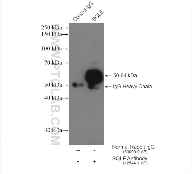 SQLE Antibody in Immunoprecipitation (IP)