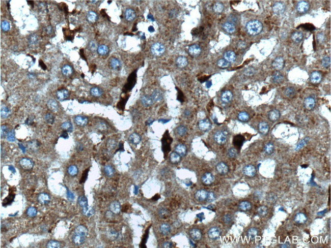 CPVL Antibody in Immunohistochemistry (Paraffin) (IHC (P))