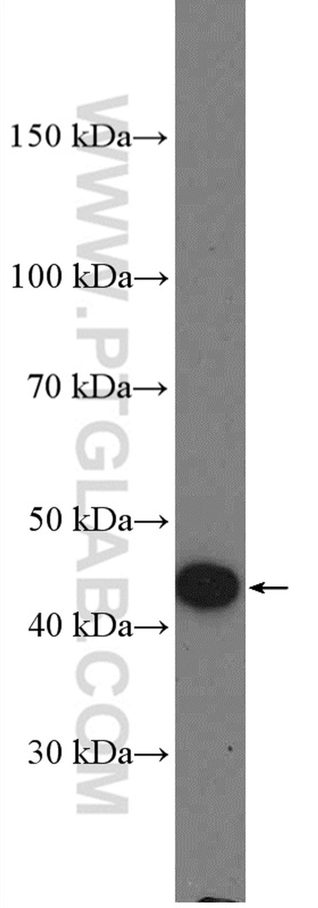 PRMT8 Antibody in Western Blot (WB)