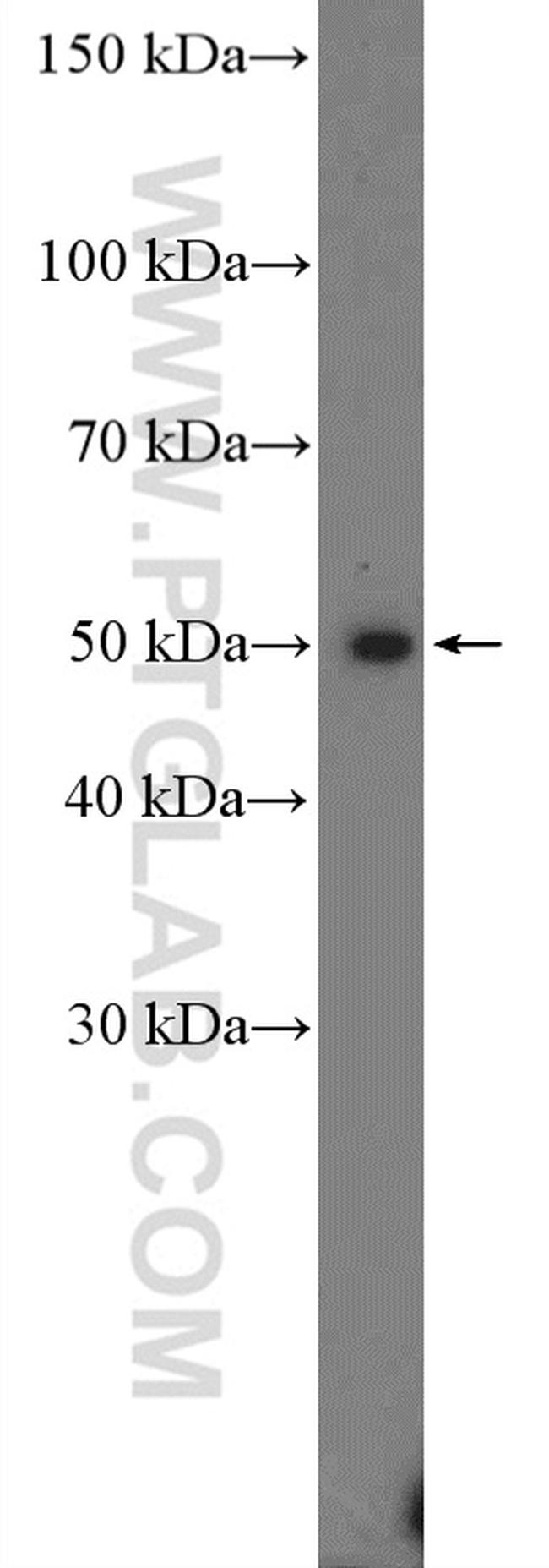 PRMT8 Antibody in Western Blot (WB)