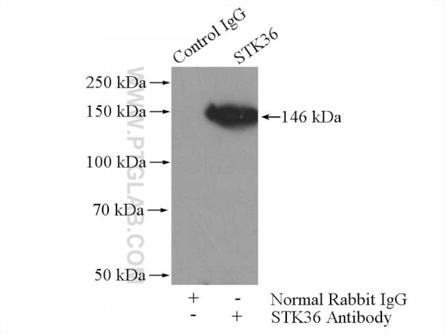 STK36 Antibody in Immunoprecipitation (IP)