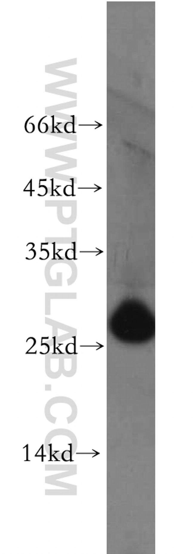 AK3 Antibody in Western Blot (WB)