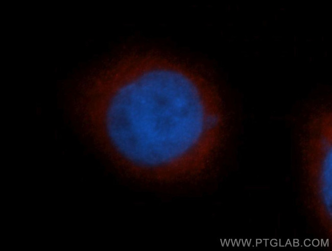 TRIM25 Antibody in Immunocytochemistry (ICC/IF)