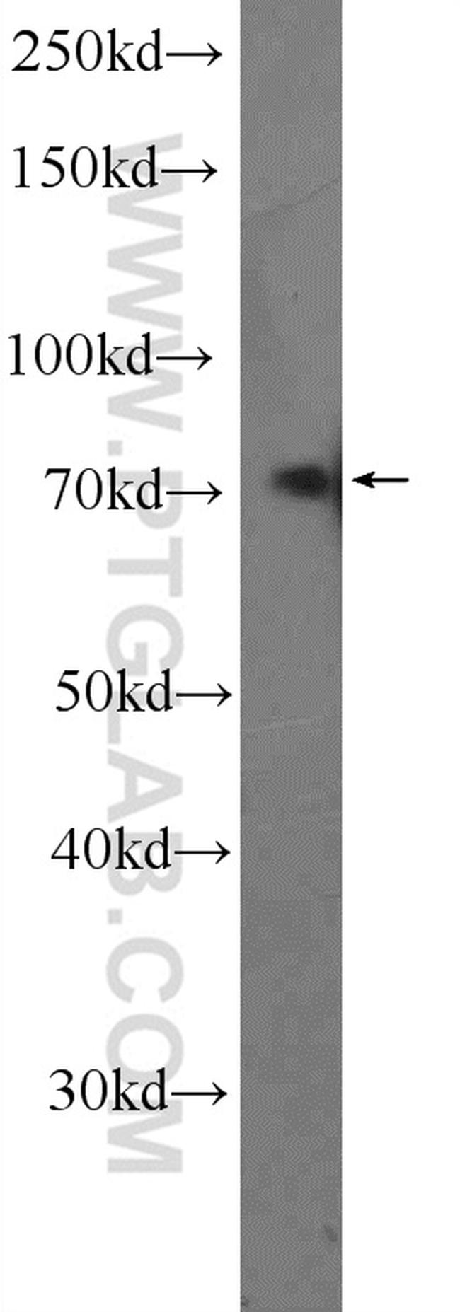 TRIM25 Antibody in Western Blot (WB)