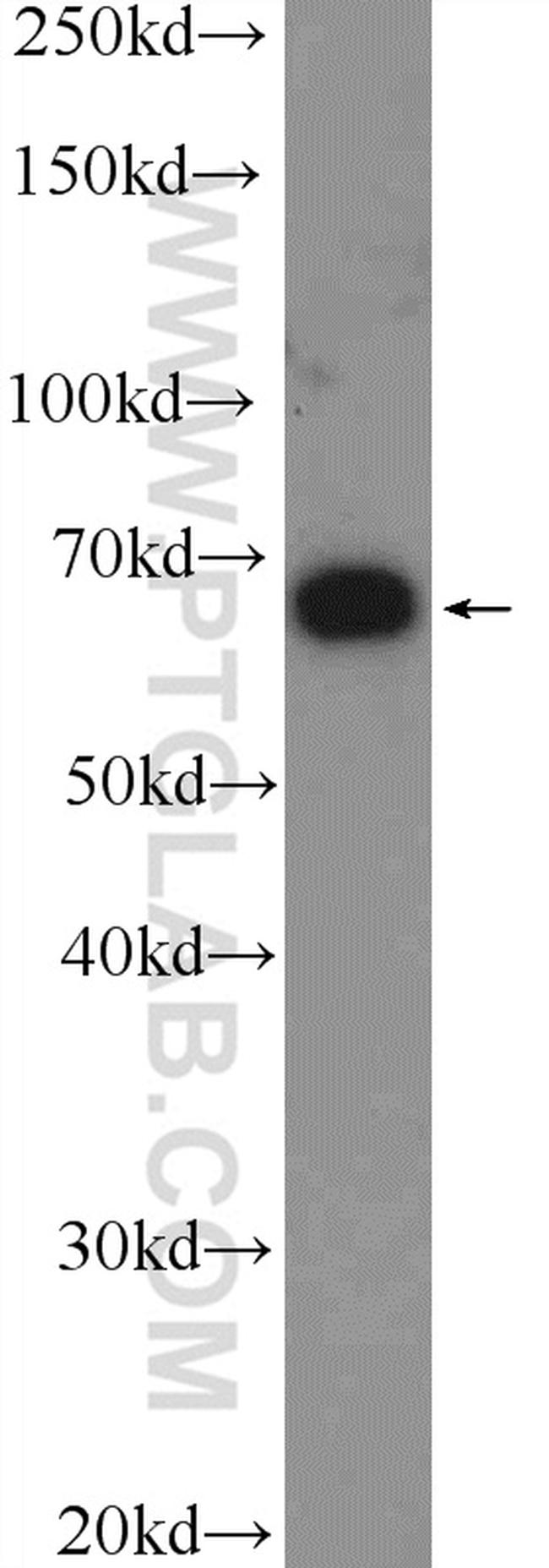 TRIM25 Antibody in Western Blot (WB)