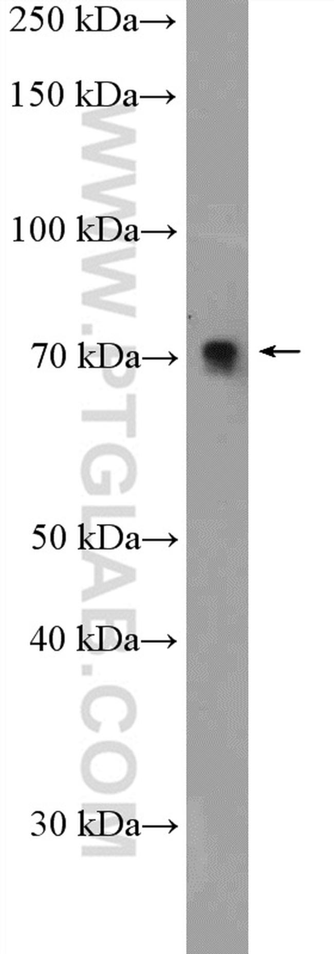 TRIM25 Antibody in Western Blot (WB)