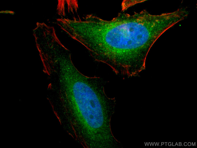 PTTG1IP Antibody in Immunocytochemistry (ICC/IF)