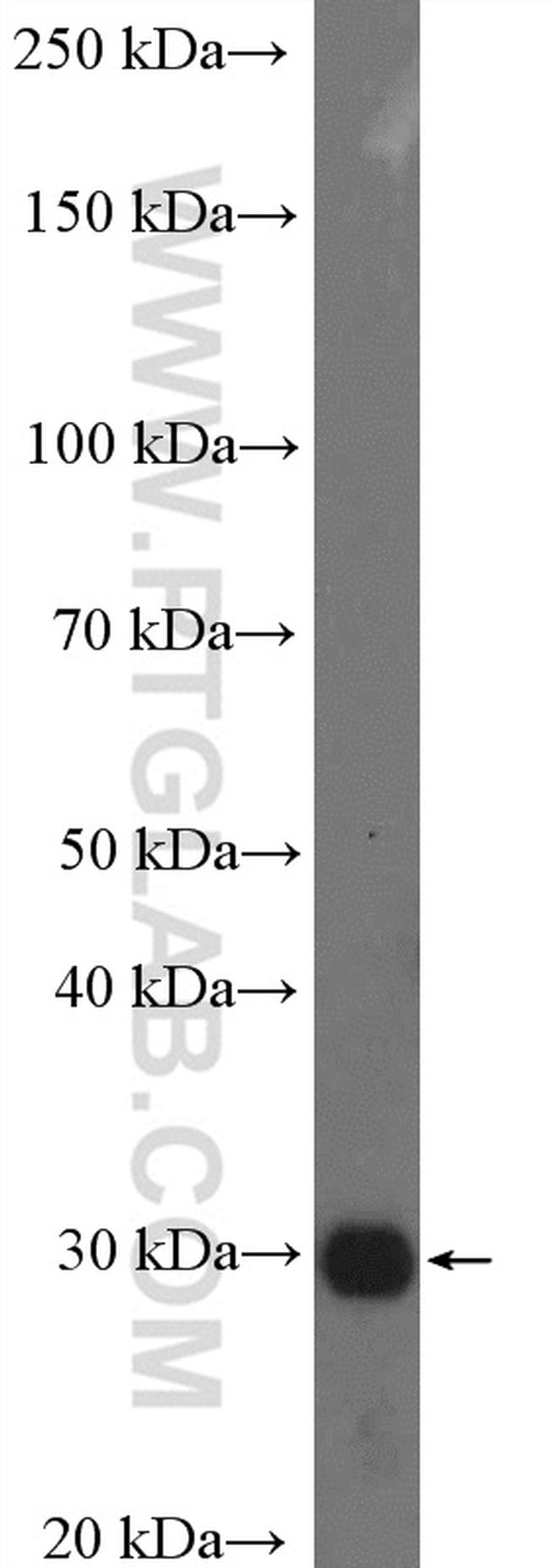SULT4A1 Antibody in Western Blot (WB)